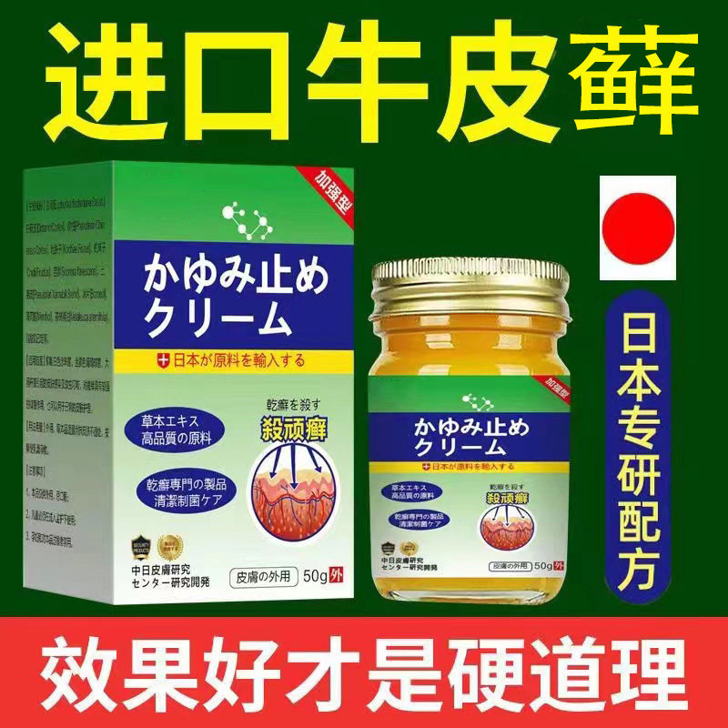 日本研发配方牛皮癣特效药膏治银屑病专用生物制剂外用牛皮藓膏药
