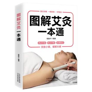图解艾灸一本通:经典彩图版 天津科学技术出版社 程振中 著 著 家庭医生QG