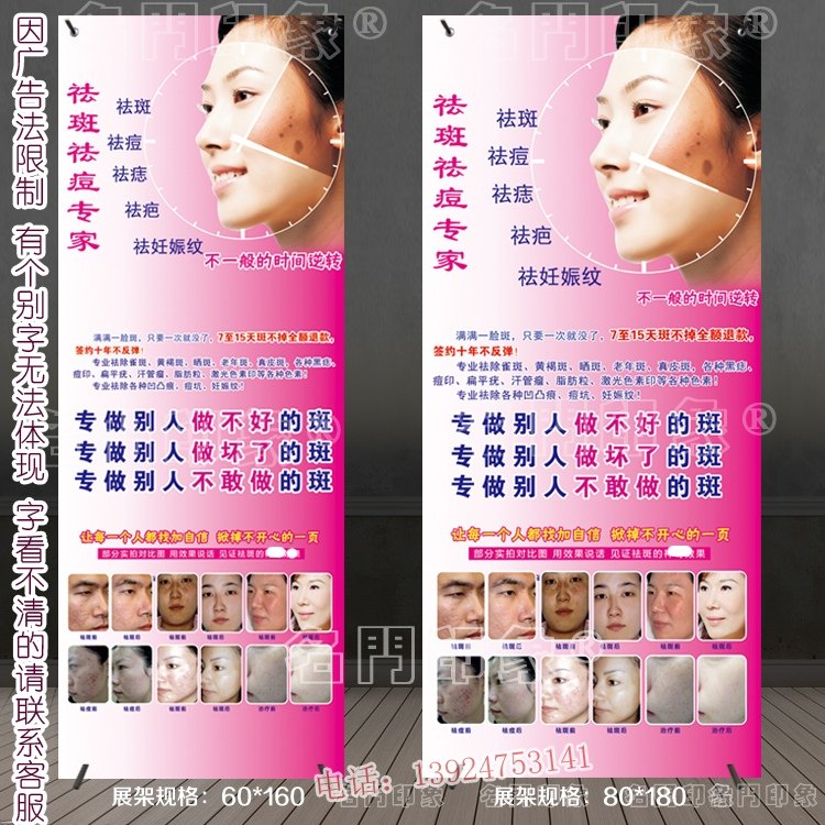 祛痘祛斑专家铁质门型展架x展架展示图消痘广告海报宣传墙贴海报|msdalam kategori Perniagaan/perabot pejabat, City Furniture, kemudahan maklumat perkhidmatan, pameran X/roll - dari Buy2taobao.com untuk memberikan perkhidmatan ejen Taobao profesional membeli
