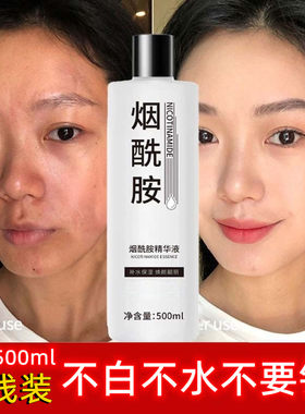 正品院线装烟酰胺面部精华液紧致抗皱抗衰老淡化细纹美白淡斑去黄