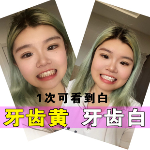 美雅仕速效牙齿美白剂精华凝胶 去天生黄牙变白 不是牙贴片洗牙粉