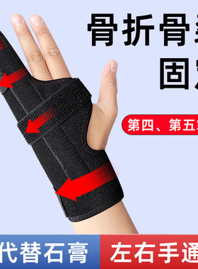 小指骨折固定护具掌骨骨折支具保护套手指关节固定器术后夹板