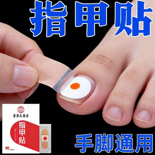 香港专研灰指防护专杀真菌指板足部美甲店灰趾美甲净萃取植物