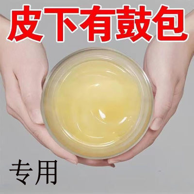 【香港正品脂肪康】皮下单发性多发性鼓包硬块肿块涂抹膏脂肪灵膏