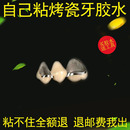 自己动手粘烤瓷牙假牙胶水牙冠粘接剂金属牙套粘合剂专用