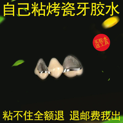 自己动手粘烤瓷牙假牙胶水牙冠粘接剂金属牙套粘合剂专用