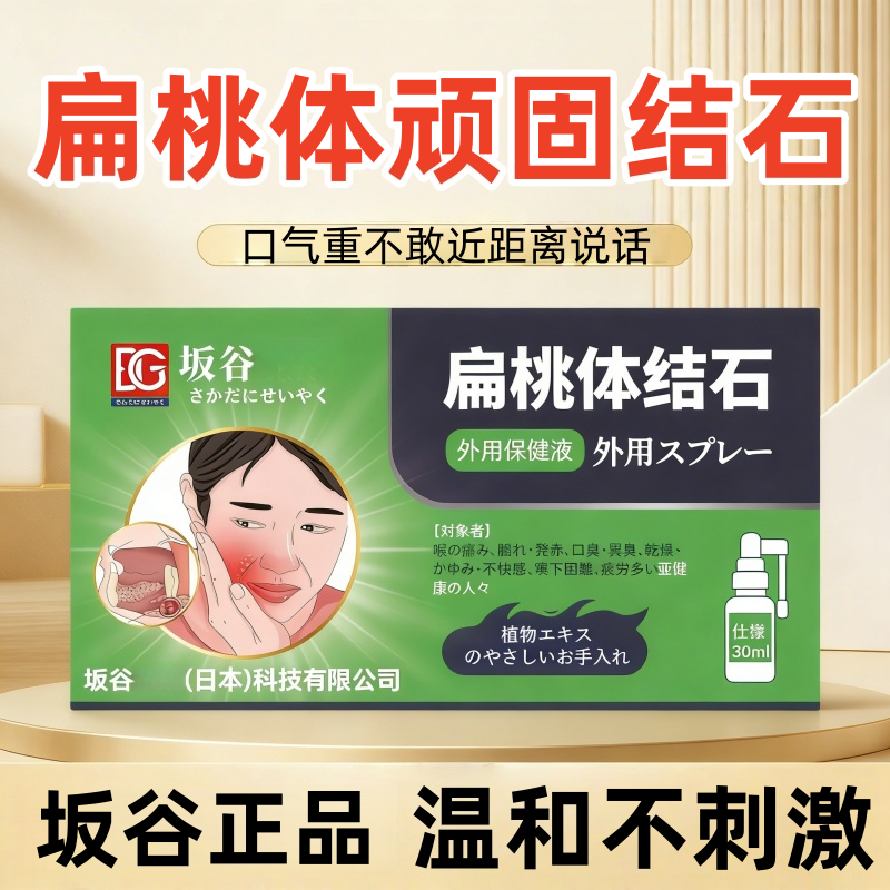 坂谷扁桃体口腔结石喷雾牙渍口气口臭喉咙异物干痒正品口腔喷雾剂