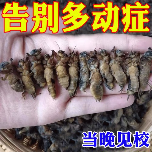 一周期去除】小儿抽动症儿童注意力不集中贴好动眨眼清嗓子耸肩G