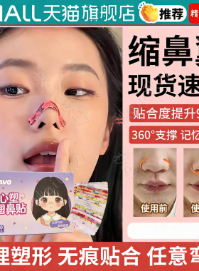 翘鼻贴鼻翼缩小贴随心塑形纠正可调节裁剪高鼻梁神器瘦鼻美鼻贴gs