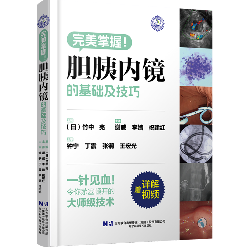 胆胰内镜的基础及技巧  主译谢威 李婧 祝建红  主审钟宁 丁震 张锎 王宏光 辽宁科学技术出版社