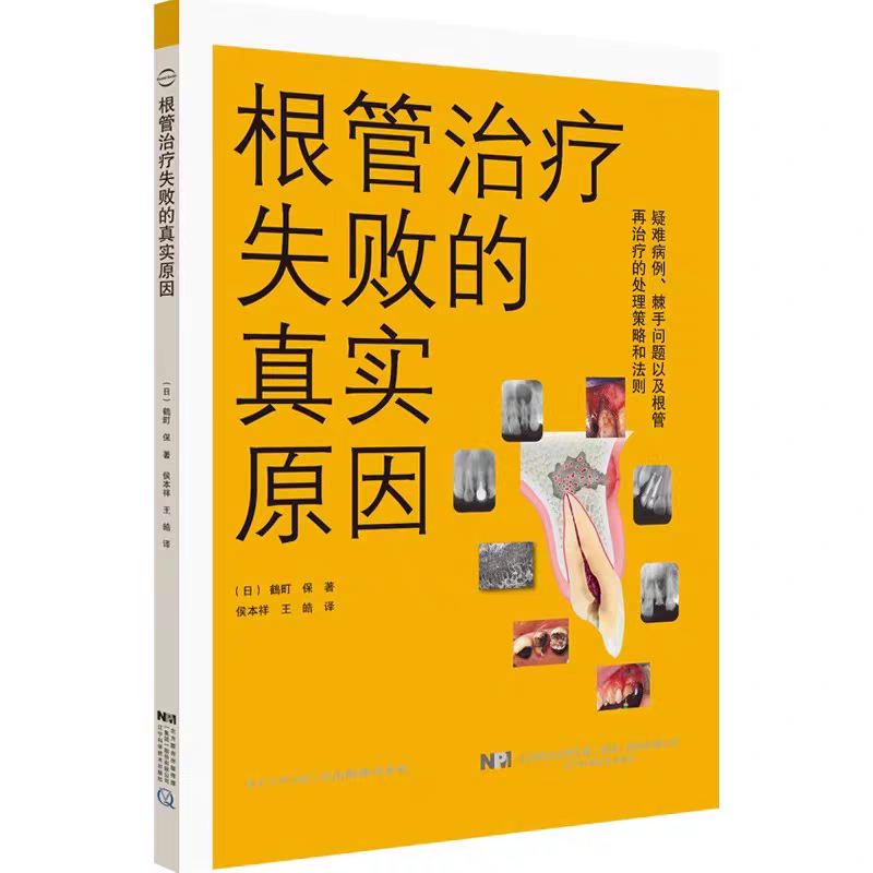 根管治疗失败的真实原因  辽宁口腔科学