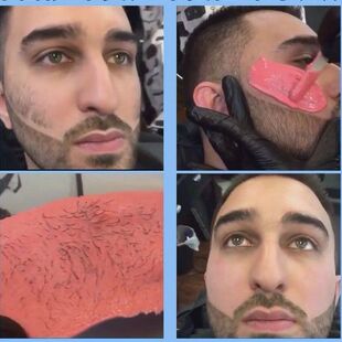 蜜蜡脱毛蜡豆拨胡子神器男人脱胡须胶撕拉式去除络腮胡大小胡子