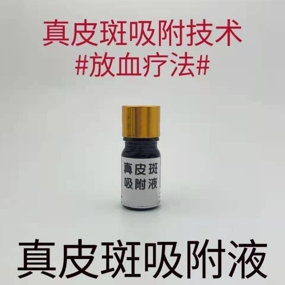 真皮斑色素真皮斑吸附液免费教技术美容院专用产品有效去班