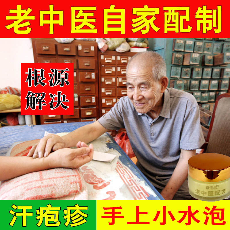 汉状汗泡汗疱疹手气手上起小水泡专用药膏汗孢疹手痒脱皮汗状软膏