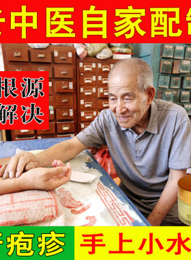 李道忠汗疹手上脱皮痒