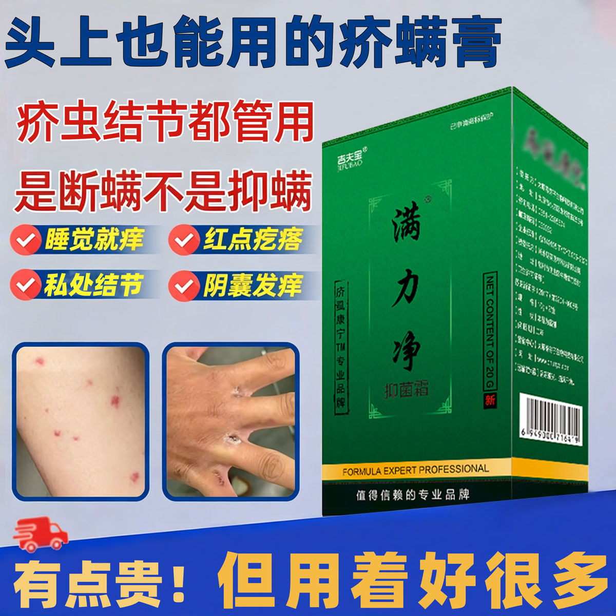 正品儿童头面部疥疮灵痒专用膏头虱子衣物杀虫喷剂满力净疥虱康宁