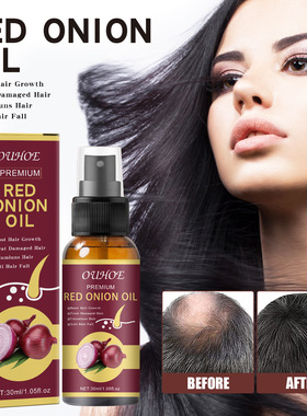 Hair Grouth Fast Onion Black Seed Essential Oils Oil Spray f