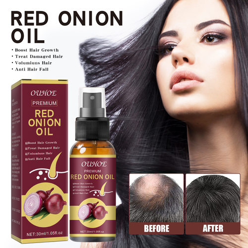 Hair Grouth Fast Onion Black Seed Essential Oils Oil Spray f