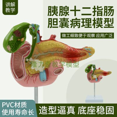 十二指肠人体模型蓝蝶教学