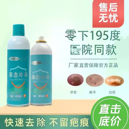 液氮冷冻尤液态氮冷冻家用干净卫生除跖尤液氮喷雾非液氮冷冻小瓶