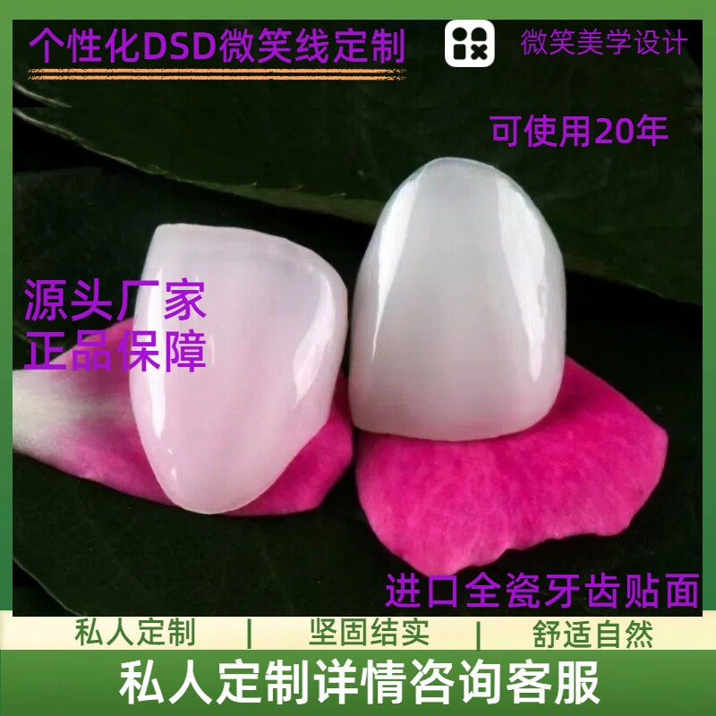 全国发货手工瓷贴面全瓷贴片贴面贴灵微瓷贴面义获嘉瓷贴片牙美白