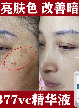377VC精华原液 提亮肤色淡化斑点黑色素熬夜修护补水保湿精华