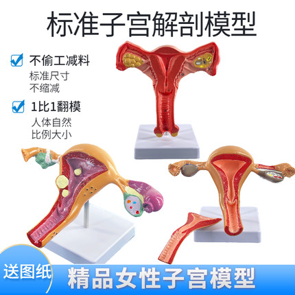 人体子宫解剖模型女性阴道生殖系统双侧卵巢子宫正常病理子宫教学