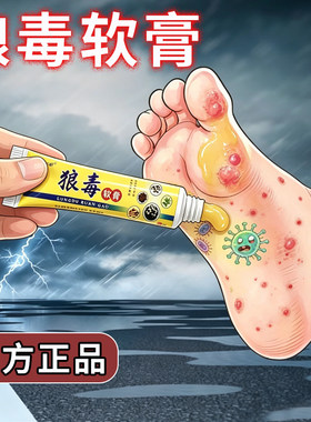狼毒脚痒手部痒水泡脱皮烂脚丫脚臭除臭脚汗膏去痒乳膏