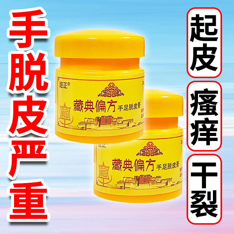 手脱皮真菌感染脱皮膏季节性手脱皮手足脱皮手脚脱皮膏痒膏