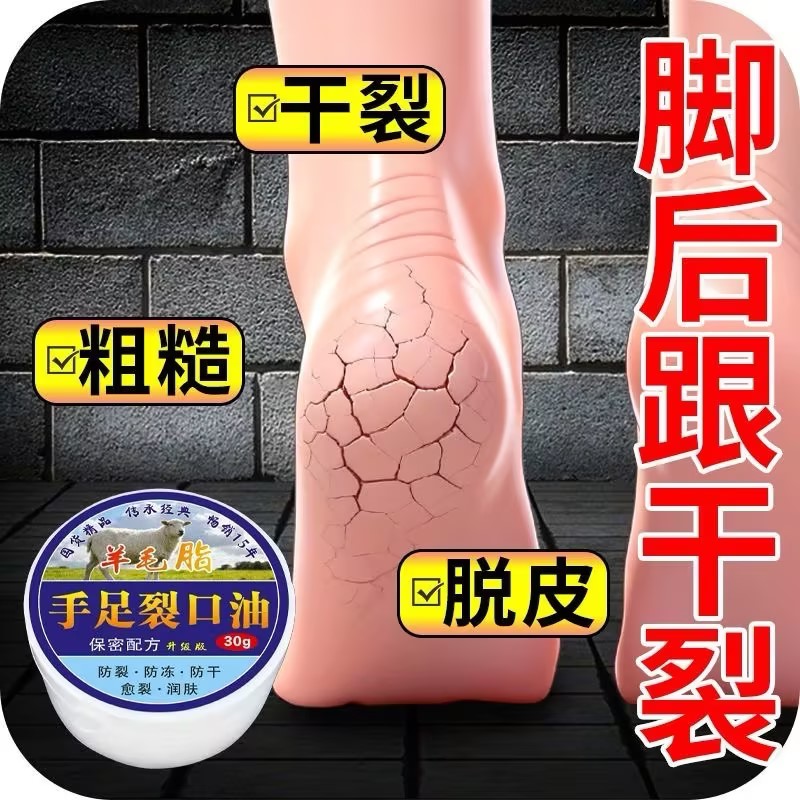 手足裂口油防裂膏护手霜女干裂手足脚后跟裂口修复手霜男补水滋润