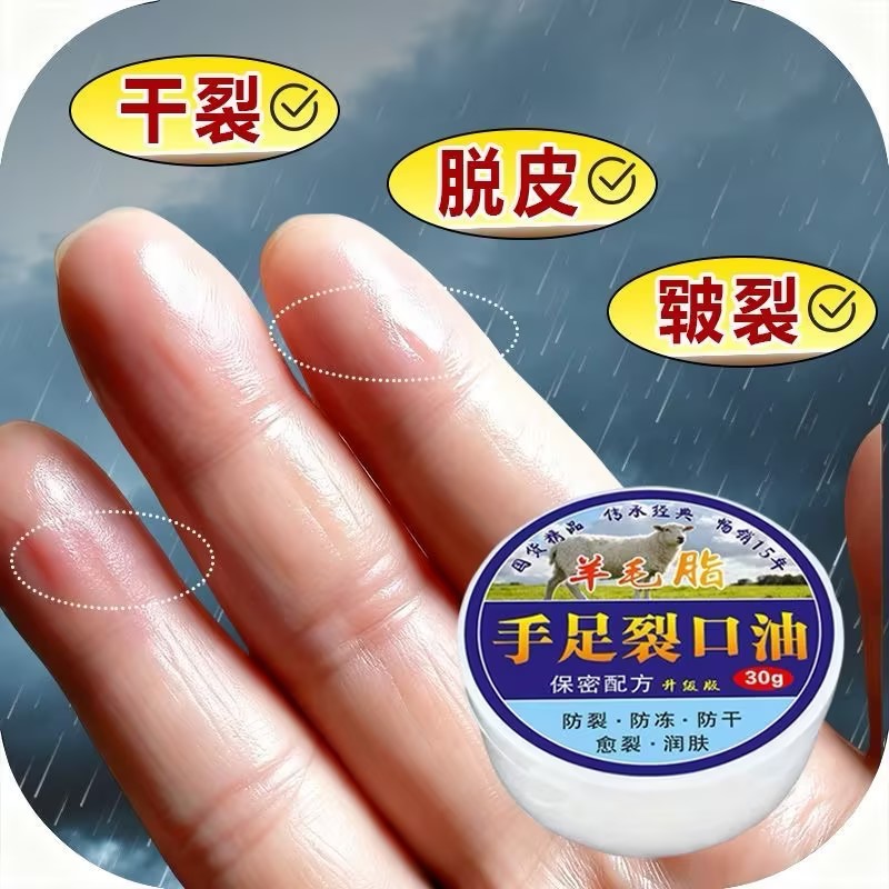 手足裂口皲裂膏脚后跟干裂手脚干皮硬皮皴裂膏去死皮防裂膏护足霜