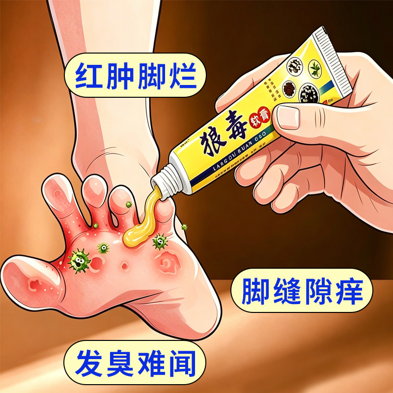狼毒脚痒手部痒水泡脱皮烂脚丫脚臭除臭脚汗膏去痒乳膏