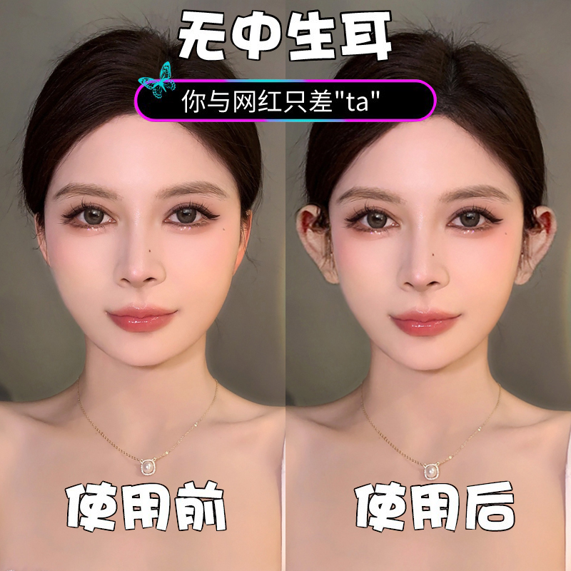 精灵耳贴显脸小拍照矫正支撑器
