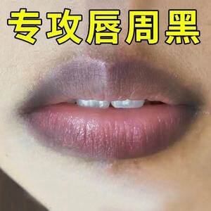 嘴角发黑去除改善唇周黑嘴唇去唇暗沉淡化唇色去唇角边唇部精华液