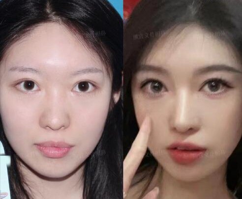 草本宽鼻缩窄精华 提升面部美鼻改善鼻部肥大
