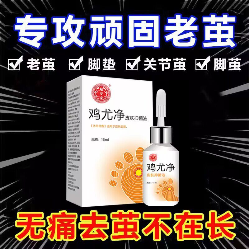 龙专家鸡尤净去鸡眼肉刺猴子扁平尤瘊子足部手部成膜液跖疣小肉粒