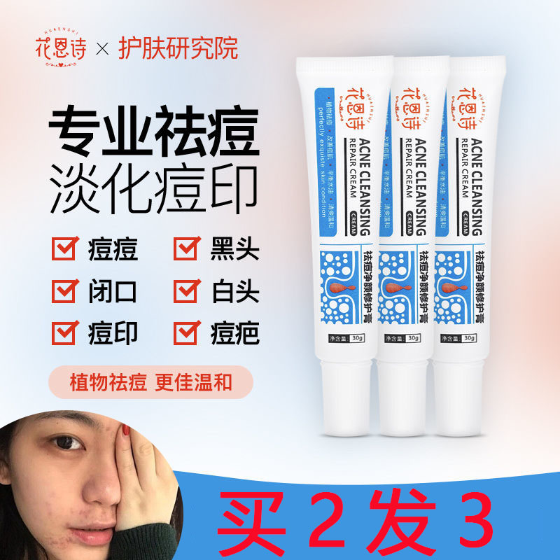 花恩诗祛痘膏中药淡印膏闭口粉刺