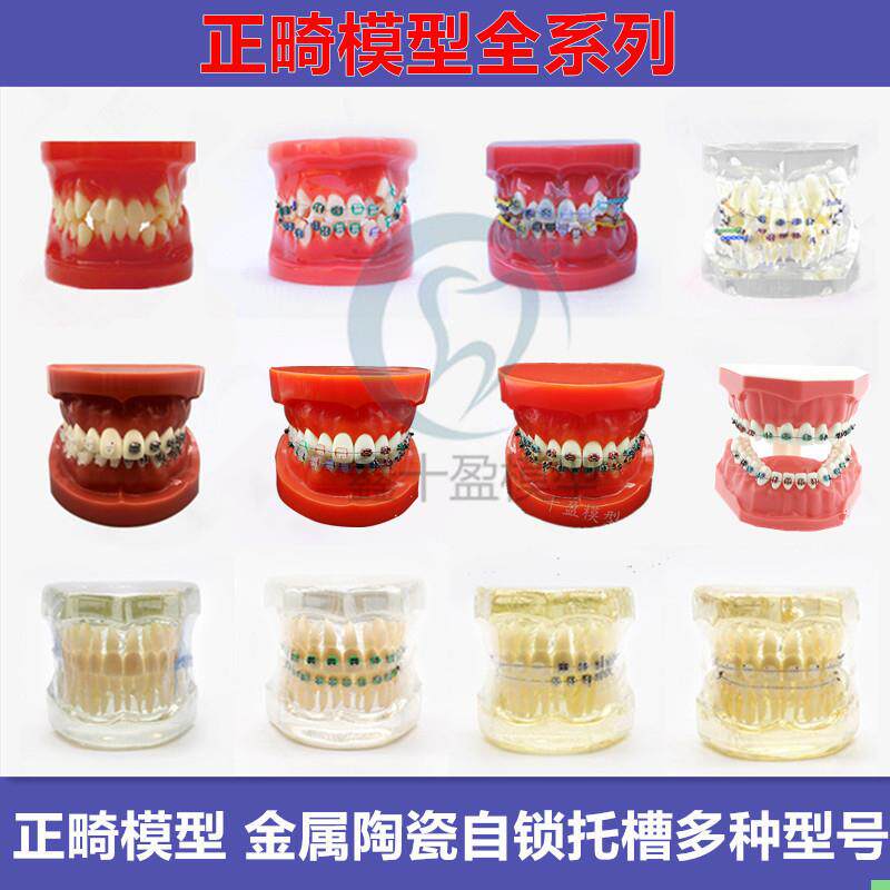 牙科口腔4种托槽对比模型 正畸教学仪器/实验器材
