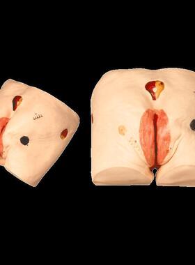 高级压疮(褥疮)护理模型GD/H90E