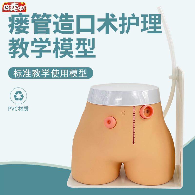 高级瘘管造口术护理模型实验室教学用品T基本护理技能模具回肠造