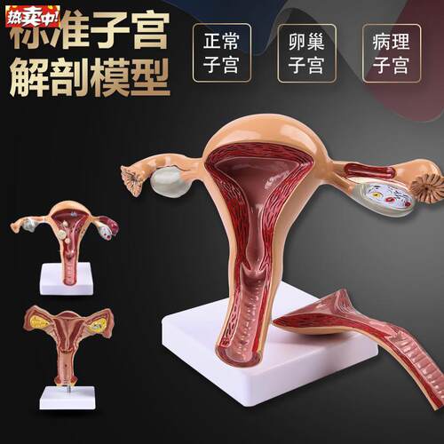 人体模型女Q性生殖子宫模型医院用病变子宫模型教具妇科解剖卵巢