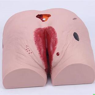 老年人褥疮(压疮)护理模型 褥疮护理模型 压疮护理模型 褥疮模型