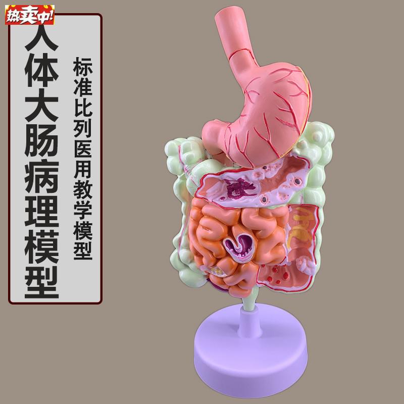 人体消化系统解剖模型大肠模型直肠十二指肠内脏肠胃解E剖构造模