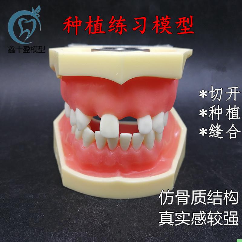牙科种植上下缺失练习切开种植缝合仿骨质牙齿模型上颌窦提升术