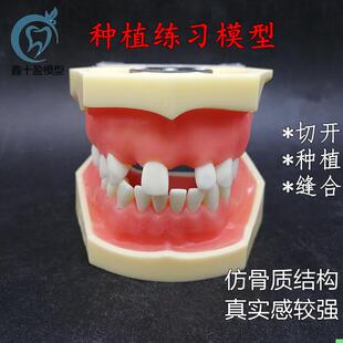 牙科种植上下缺失练习切开种植缝合仿骨质牙齿模型上颌窦提升术