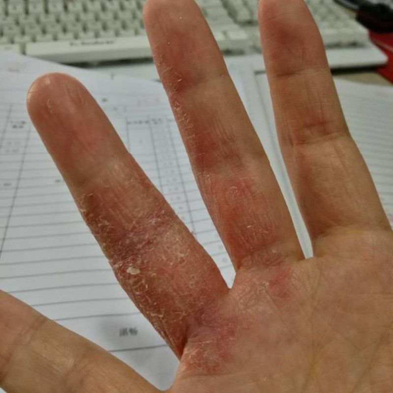 手脱皮手裂口干裂修复霜秋冬季指甲缝干裂手干燥手脚防皲裂愈合膏