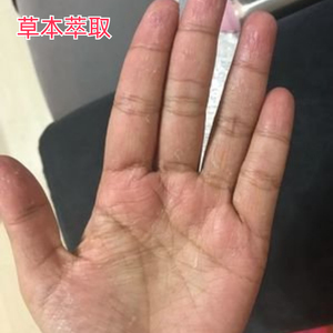 【老板娘亲测好用】已用好10W+人用过不后悔~~买二送一 买三送二
