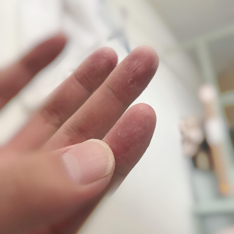 手脱皮季节性修复霜手掌手指头蜕皮开裂干裂维生素手起皮掉皮爆皮