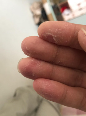 抖音同款手气手脱皮膏水泡手掌开裂干裂手蜕皮修复霜手上起皮爆皮