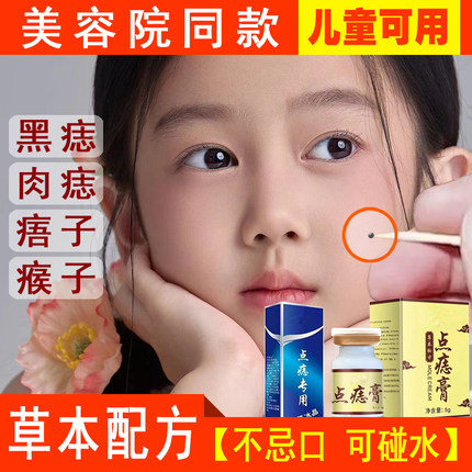 【美容院同款】祛痣点痣膏无痕不留疤肉痣痦子去除神器专用药水